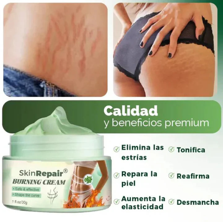 SKIN REPAIR ™| TU CREMA ANTIESTRÍAS - ¡Elimina Tus Estrías en hasta 3 Semanas! - Bora De Compras