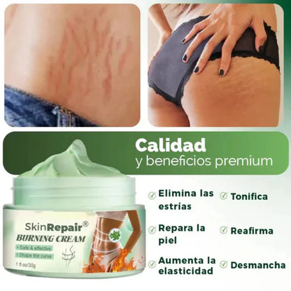 SKIN REPAIR ™| TU CREMA ANTIESTRÍAS - ¡Elimina Tus Estrías en hasta 3 Semanas! - Bora De Compras